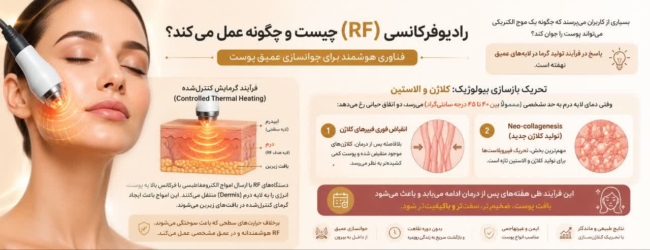 رادیوفرکانسی (RF) چیست و چگونه عمل می‌کند؟ (مکانیسم عمل)